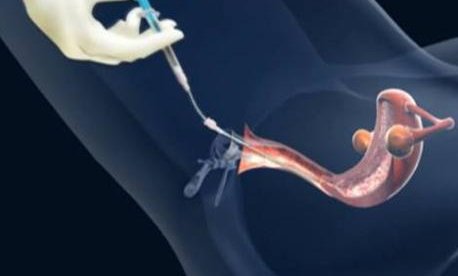 2026岳阳第三代试管婴儿助孕生孩子机构排名汇总