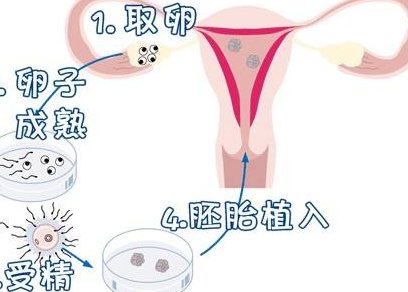 2026南京三代试管助孕机构排行来袭，出名的试管医院可有好几家